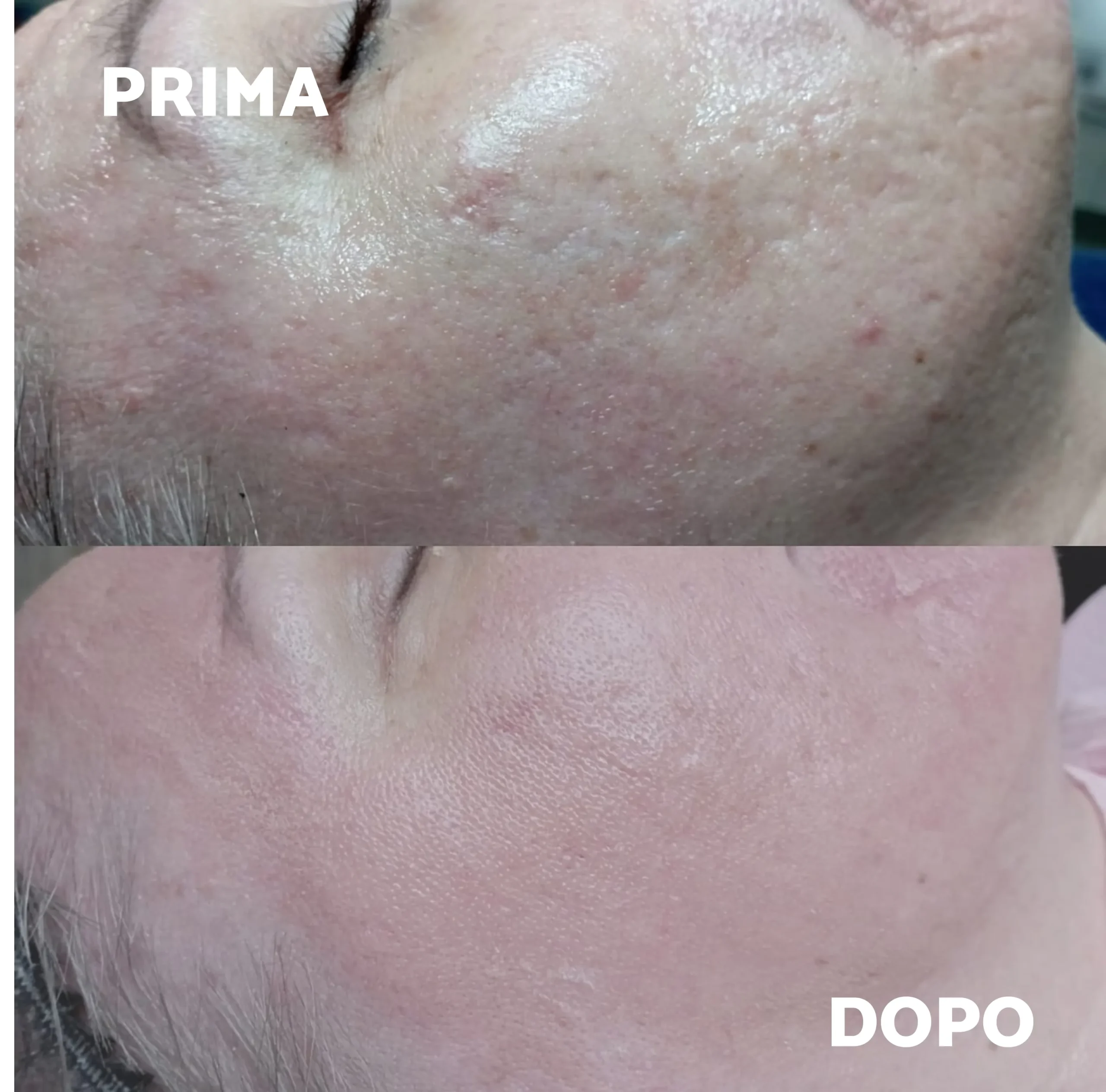 Prima e dopo Aqus-Derma